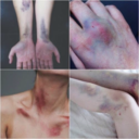 prettylittle-bruises avatar