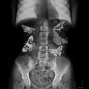 stomachmeet-butterflies-blog avatar